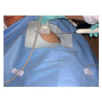 Ultrasound Sterile Biopsy Drape