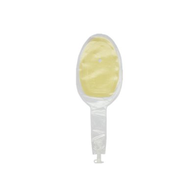 Eakin Fistula and Wound Pouch